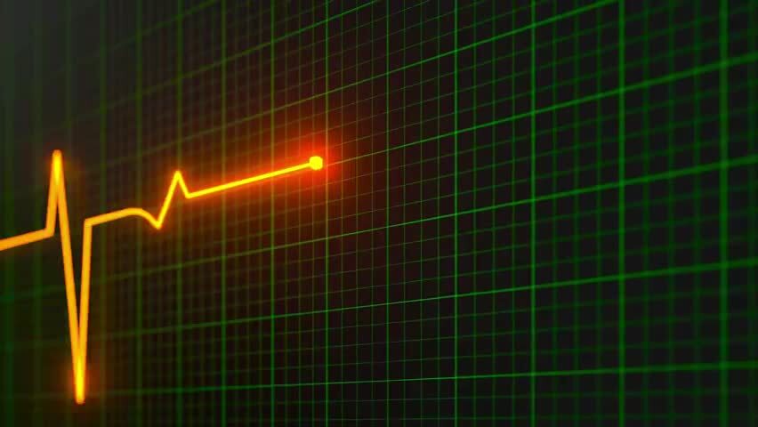 绿色屏幕上的心脏图曲线