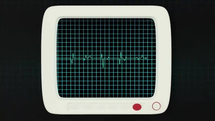 绿色屏幕上的心脏图曲线