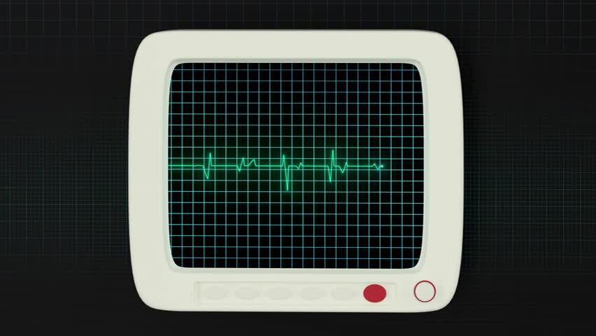 绿色屏幕上的心脏图曲线